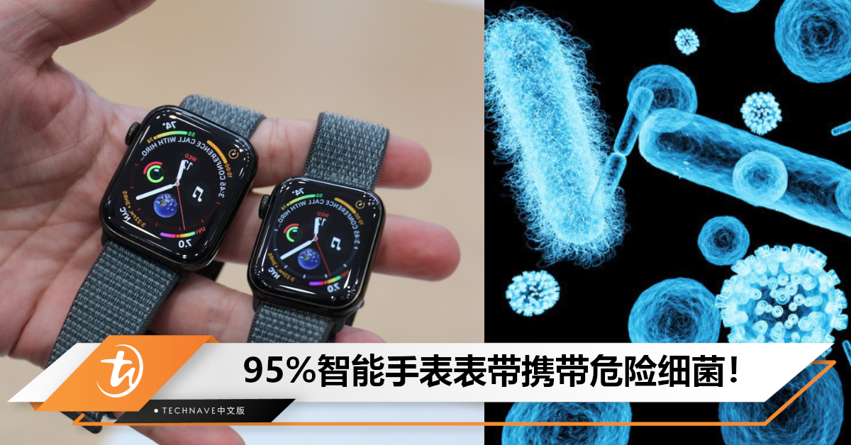 请定期清理手表！研究表明：95% 智能手表表带携带某种危险细菌，其中布表带携菌数最高！