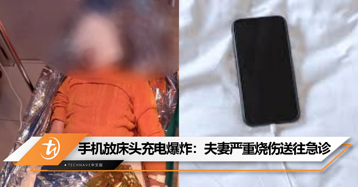 手机放床头充电爆炸：夫妻严重烧伤送往急诊治疗