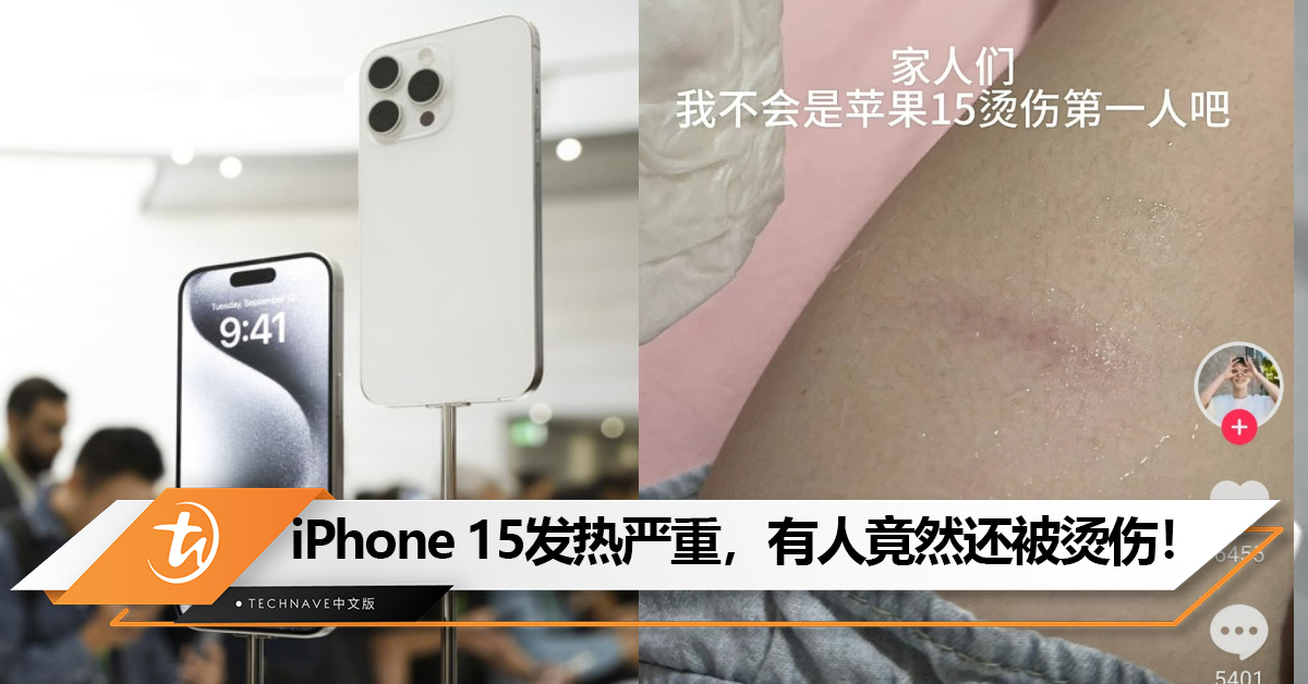 那么夸张？iPhone 15发热严重，有人竟然还被烫伤！
