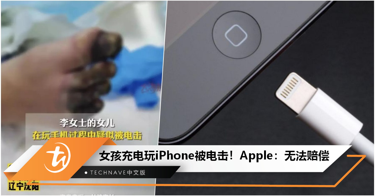 女孩边充电边玩iPhone遭电击，内脏受损面临截肢！Apple客服回应：第三方适配器导致，无法赔偿！