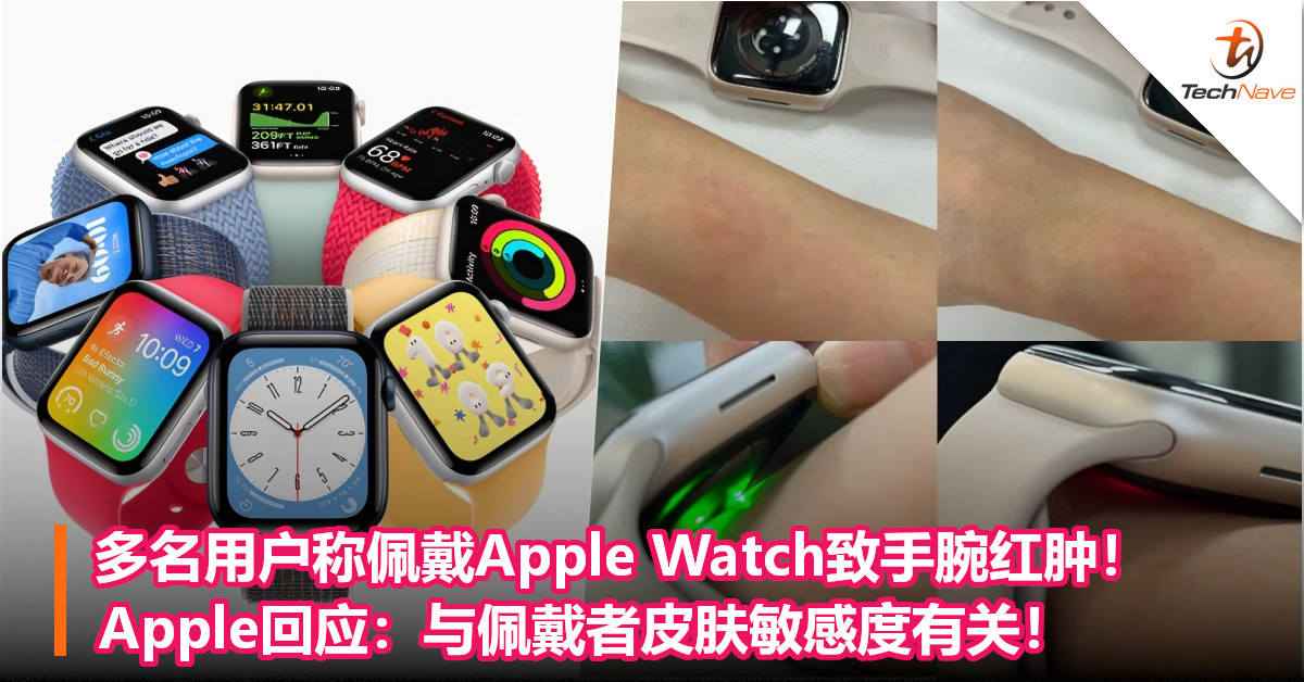 多名用户称佩戴Apple Watch致手腕红肿！Apple回应：与佩戴者皮肤敏感度有关！