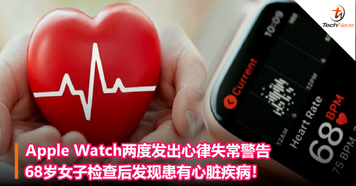 Apple Watch两度发出心律失常警告，68岁女子检查后发现患有心脏疾病！