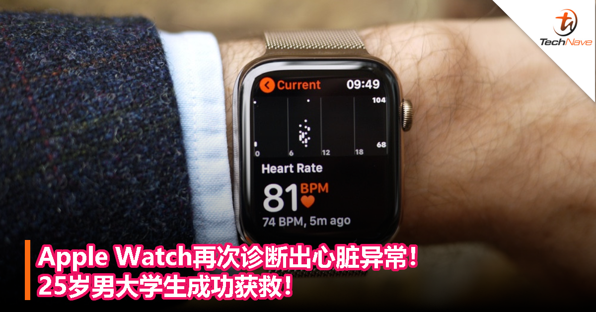 Apple Watch再次诊断出心脏异常！25岁男大学生成功获救！