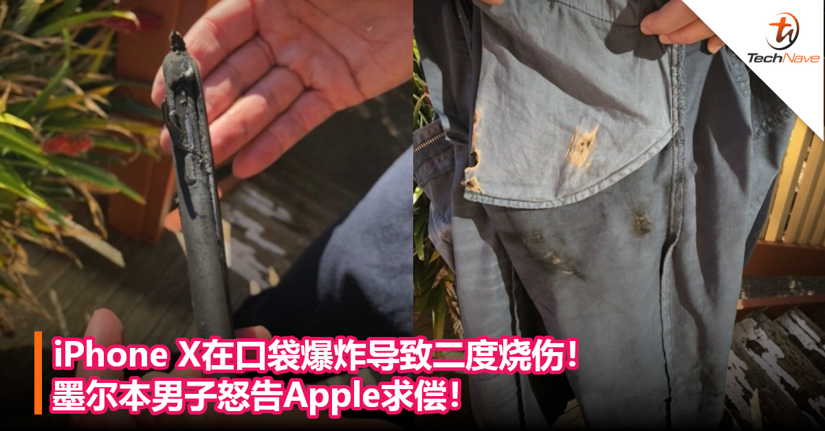 iPhone X在口袋爆炸导致二度烧伤！墨尔本男子怒告Apple求偿！