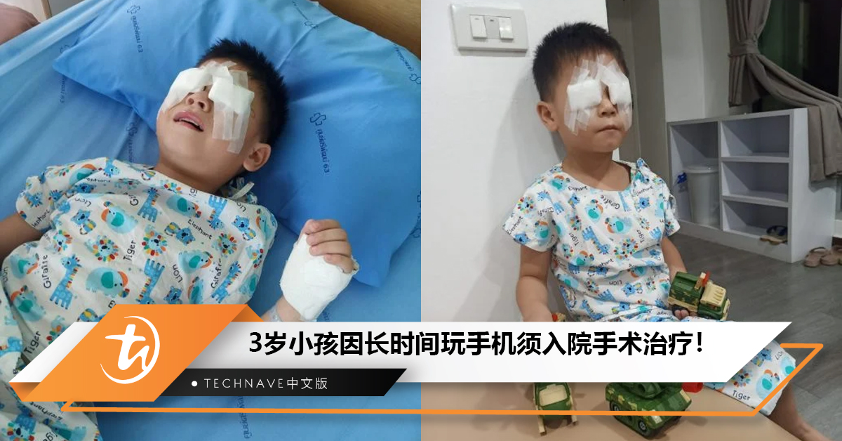3岁小孩因长时间玩手机患上斜视和懒惰眼问题须入院手术治疗！