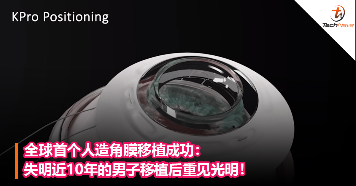 全球首个人造角膜移植成功： 失明近10年的男子移植后重见光明！