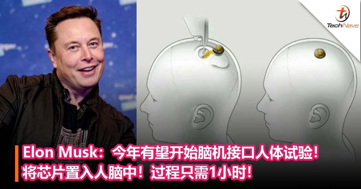 全新科技时代即将到来？Elon Musk：今年有望开始脑机接口人体试验！将芯片置入人脑中！过程只需1小时！
