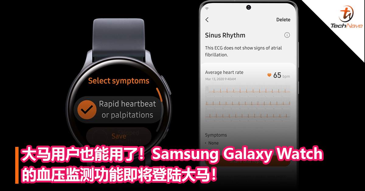 大马用户也能用了！Samsung Galaxy Watch血压监测功能即将登陆大马！