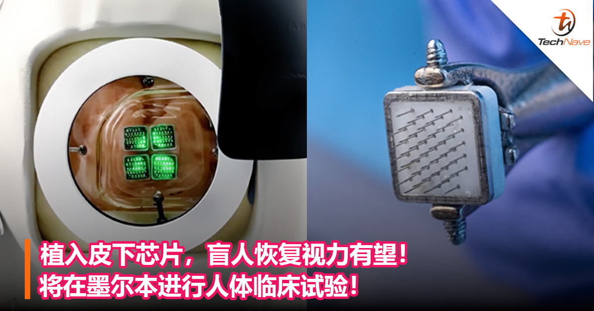 北京芯片植入人体图片